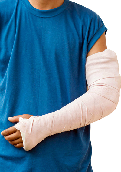 Deer Velvet + Astaxanthin health supplements for elbow injury, broken arm & fractures